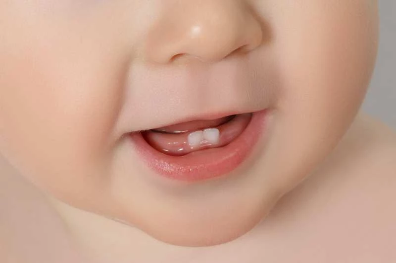Răng có phải là một "mẫu xương" đặc không?